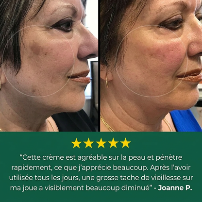 Crème contre les tâches de vieillesse