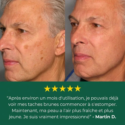 Crème contre les tâches de vieillesse